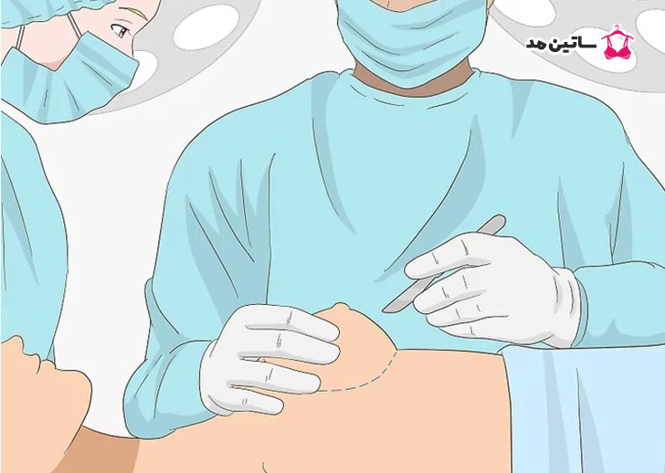 فرآیند جراحی سینه چقدر طول می‌کشد؟